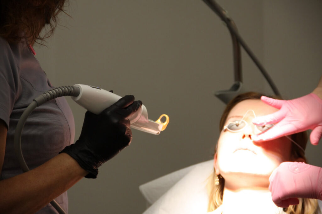 Laser Excel V+ Cutera – usuwanie pajączków, przebarwień i zmarszczek - Klinika Dr Stachura Galeria 09