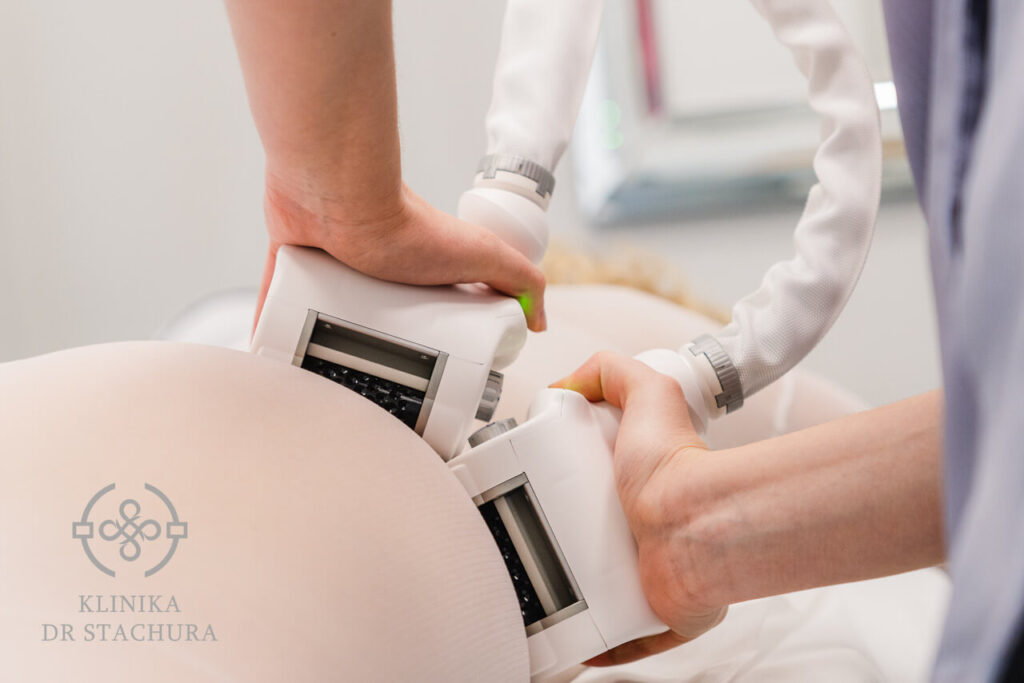Treatment photos - icoone3