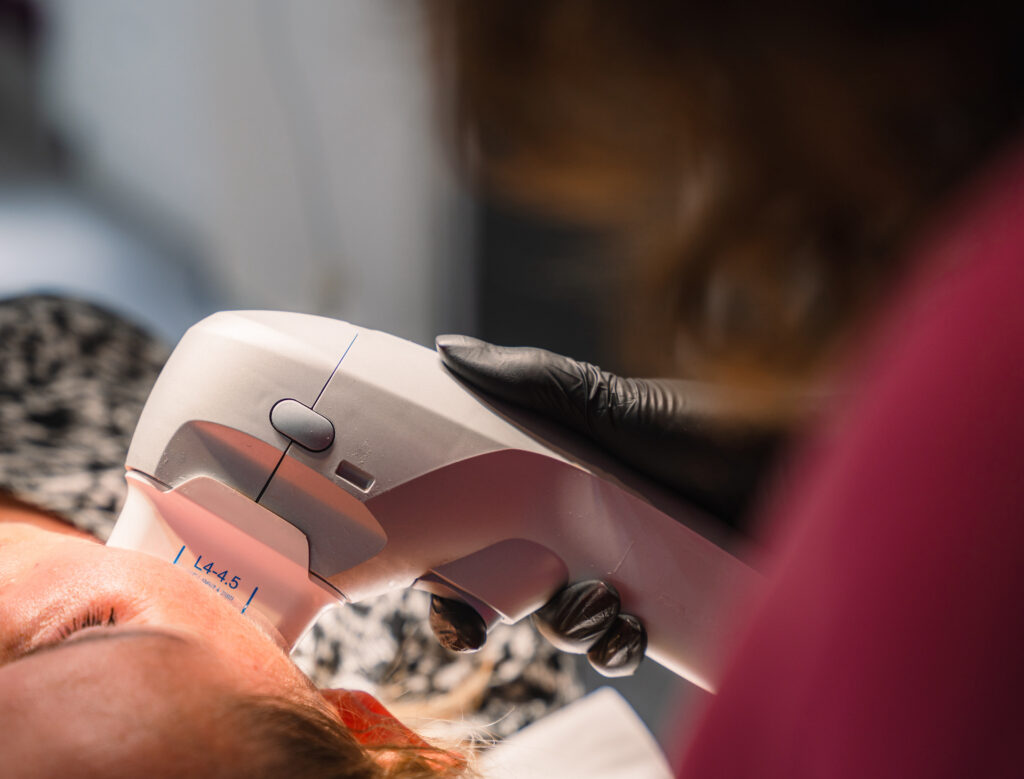 Treatment photos - utraformer2